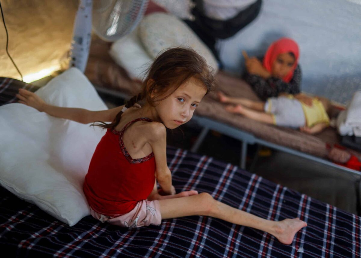 Medics aim to screen thousands of Gaza children for malnutrition ...